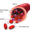 cbc test elevated basophils elevated lymphocytes complete blood count