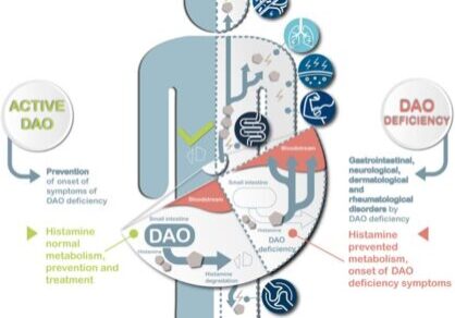 inflammation dao levels